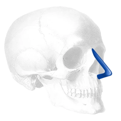 DCI Nasal Burun İmplantı | Dorsal Columella